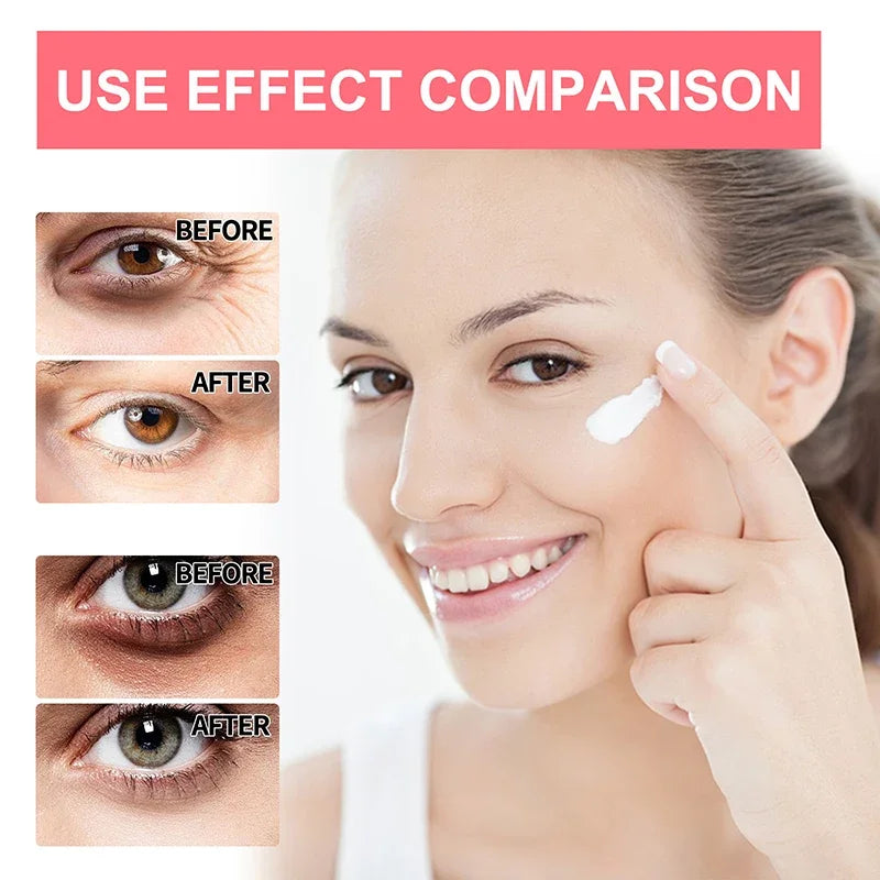 Anti-Wrinkle Eye Cream Retinol Remove Eye Bags Dark Circles Anti Aging Lifting Firming